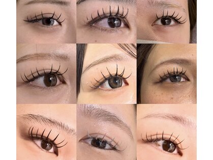 ホワイトニングショップ(whitening shop)の写真