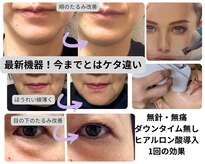 エステサロン プラスエー(+A)