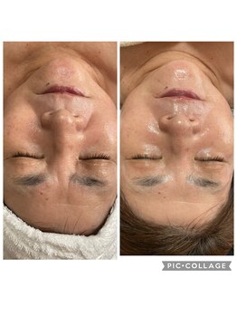 スズ(SUZU)の写真/脱ブルドッグ！ツヤ×ハリうるおいUP!!!!