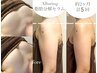 夏前人気!ゲリラ価格【ミラクルバスト+二の腕脂肪分解セラムケア】