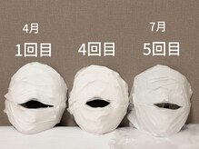 ルアナ(Luana)/3ヶ月の変化　小顔ヘッドスパ