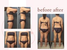 ミチ 整体サロン(michi)/ハイパーナイフ施術