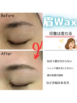 ルル(RuRu)/Wax脱毛