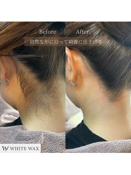 ホワイトワックス 浜松(WHITE WAX)/自然に仕上げるうなじ脱毛