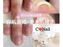 シーネイル(C Nail)