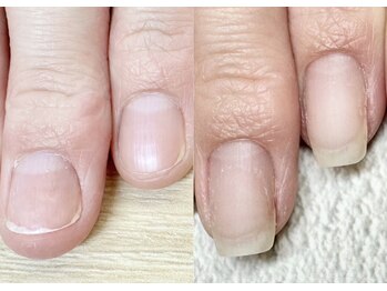 ネイルサロン ミノアッカ(mino'aka)の写真/【県外からも指名殺到】時間とお金を無駄にしない、爪トラブルの“最終受付”。歴16年の機能回復技術。