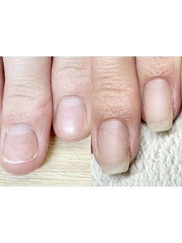 スゴ腕の施術者がいるサロン