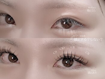 マミノン 武蔵小杉(Maminon)/【矯正する？しない？】比較