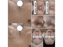 マイレ 平塚店(Maile)の雰囲気(様々な肌悩みに対応してフェイシャルトリートメント)