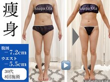 アナパ・オラ/マグニート×6種痩身マシン