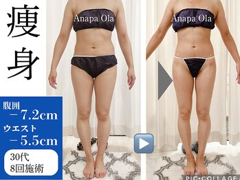 アナパ・オラ/マグニート×6種痩身マシン