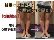 O脚矯正 スタイレックスに関するサロン 小顔矯正・O脚・骨盤矯正 