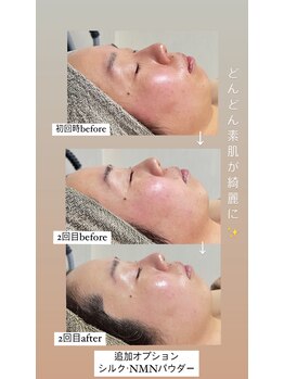 クレヴィー(Creviy)/陶肌×シルク＋NMNパウダー