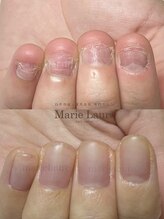マリーロール 淀屋橋本店(Marie Laure)/自爪育成/深爪矯正/ネイルケア