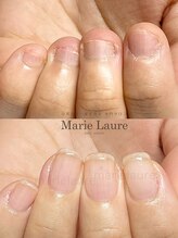 マリーロール 淀屋橋本店(Marie Laure)/自爪育成/深爪矯正/ネイルケア