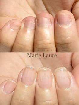 マリーロール 淀屋橋本店(Marie Laure)/自爪育成/深爪矯正/ネイルケア