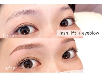ソソ(soso)の写真