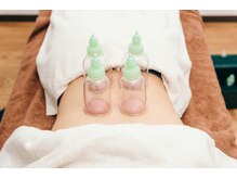 サンキュー鍼灸院整体院の雰囲気（カッピングMENU　アスリートも使っている療法です。お試しあれ♪）