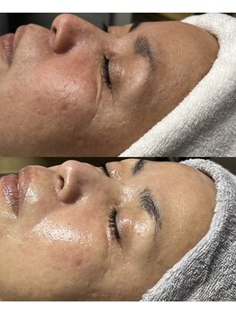 ルミナ シブヤ(LUMINA SHIBUYA)/Before→After