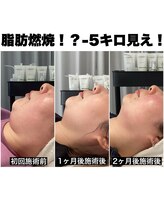 リシェ 市川(riche)/