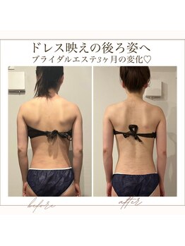 マージェ(magie)/ブライダルエステ