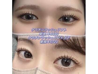 ミューシグ(Mysig)の写真