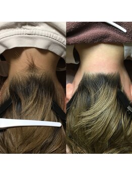 ミヌエット 新宿御苑(Minuet)/うなじダブル