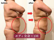 クレンズ(CLeanse)/30代ボディ全身105分体験の変化