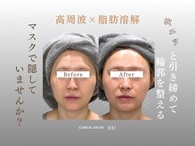 ジュジュ(juju)/顔下マスクで隠していませんか？