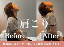 ローリエの雰囲気（「肩周りをほぐすことで姿勢が整い、毎日を快適に過ごせます。」）