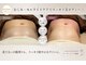 ココロ(COCORO)の写真/《韓国コルギ》の血行促進＆小顔効果と《キャビテーション×高周波》の本格痩身で、夏前に生まれ変わる！