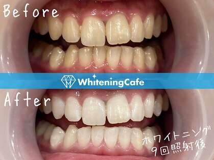 ホワイトニングカフェ 秋葉原店(WhiteningCafe)の写真