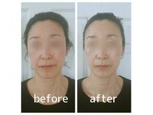 アジアンビューティー(Asian Beauty)の雰囲気(有名雑誌掲載!左右差、ほつれい線、ゆがみを取り去るコルギ)