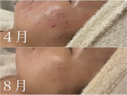 ステラ(Stella)の写真