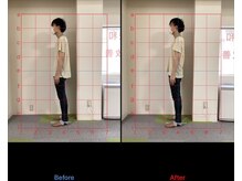 けいのき鍼灸整骨院/姿勢から身体を楽に!整体/肩こり