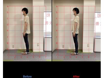 けいのき鍼灸整骨院/姿勢から身体を楽に!整体/肩こり