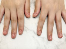 エスディーネイルズ(sd nails)/クリアネイルで育爪