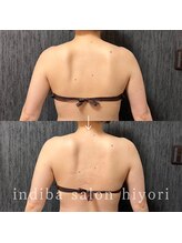 ヒヨリ(hiyori)/《before/after》上半身