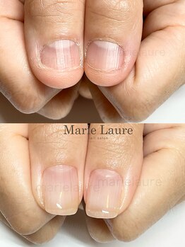 マリーロール 淀屋橋本店(Marie Laure)/自爪育成/深爪矯正/ネイルケア