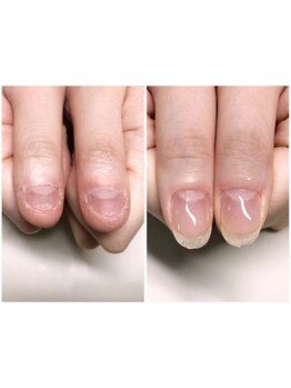 爪の悩みを解消できる（ケア含む）