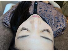 目頭のかゆみ等、気になる事を最大限取り除ける施術をします。