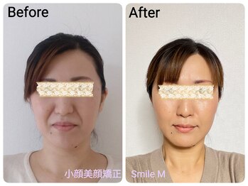 スマイルエム(SmileM)/