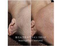 トゥルーリー(TRULY)の雰囲気（洗顔美顔器&ワックス脱毛で超美肌♪気持ちよくスッキリ綺麗に♪）