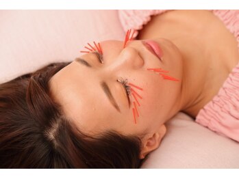 メイロン(meilong)/くま・ほうれい線美容鍼