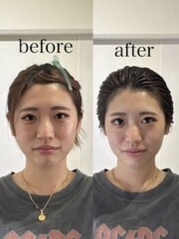 エメ 倉敷店(Aimer)/骨格補正ヘッドスパハチ張り解消