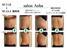 サロンアオバ 稲毛店(salon Aoba)の雰囲気(脂肪冷却で無理のない痩身ダイエットが魅力です)