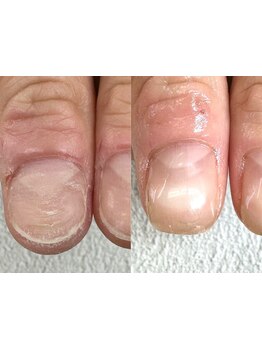 爪の悩みを解消できる（ケア含む）