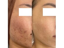 根本から改善し、リバウンドさせません◎