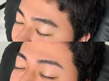 イブ(Eve)/ビフォーアフター