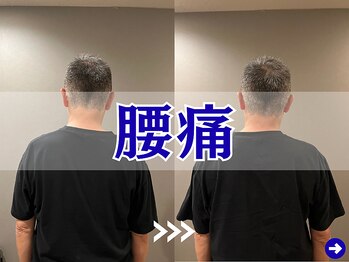 A1スポーツマッサージ治療院/【腰痛施術】反り腰・猫背も改善